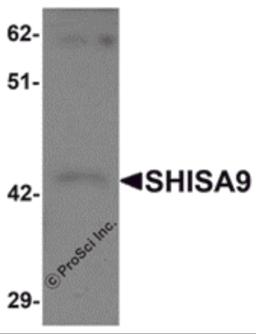 Western blot analysis of SHISA9 in rat brain tissue lysate with SHISA9 antibody at 1 &#956;g/mL.