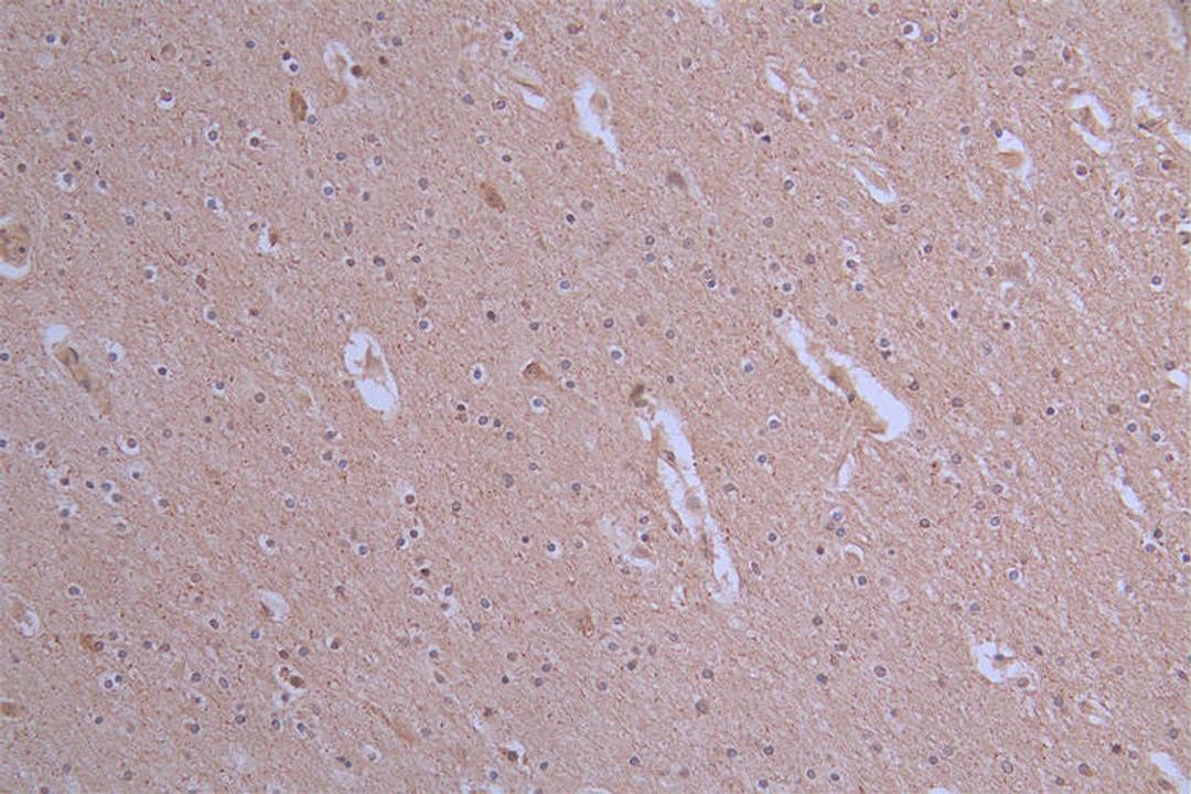 IHC image of CSB-RA175460A0HU diluted at 1:50 and staining in paraffin-embedded human brain tissue performed on a Leica BondTM system. After dewaxing and hydration, antigen retrieval was mediated by high pressure in a citrate buffer (pH 6.0). Section was blocked with 10% normal goat serum 30min at RT. Then primary antibody (1% BSA) was incubated at 4°C overnight. The primary is detected by a Goat anti-rabbit polymer IgG labeled by HRP and visualized using 0.19% DAB.