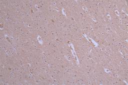 IHC image of CSB-RA175460A0HU diluted at 1:50 and staining in paraffin-embedded human brain tissue performed on a Leica BondTM system. After dewaxing and hydration, antigen retrieval was mediated by high pressure in a citrate buffer (pH 6.0). Section was blocked with 10% normal goat serum 30min at RT. Then primary antibody (1% BSA) was incubated at 4°C overnight. The primary is detected by a Goat anti-rabbit polymer IgG labeled by HRP and visualized using 0.19% DAB.
