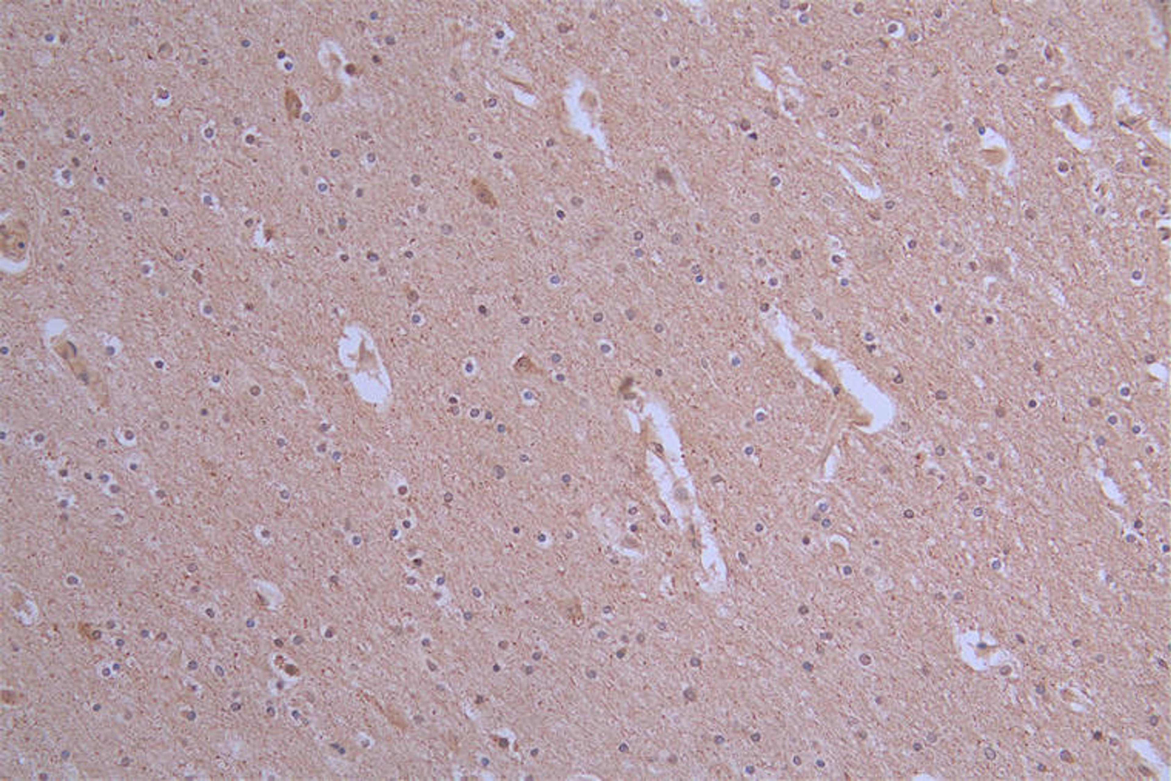 IHC image of CSB-RA175460A0HU diluted at 1:50 and staining in paraffin-embedded human brain tissue performed on a Leica BondTM system. After dewaxing and hydration, antigen retrieval was mediated by high pressure in a citrate buffer (pH 6.0). Section was blocked with 10% normal goat serum 30min at RT. Then primary antibody (1% BSA) was incubated at 4°C overnight. The primary is detected by a Goat anti-rabbit polymer IgG labeled by HRP and visualized using 0.19% DAB.