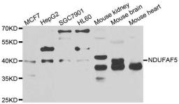 Western blot analysis of extracts of various cell lines using NDUFAF5 antibody