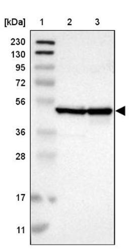 Western Blot: Cyclin B2 Antibody [NBP1-89657] - Lane 1: Marker [kDa] 230, 130, 95, 72, 56, 36, 28, 17, 11<br/>Lane 2: Human cell line RT-4<br/>Lane 3: Human cell line U-251MG sp