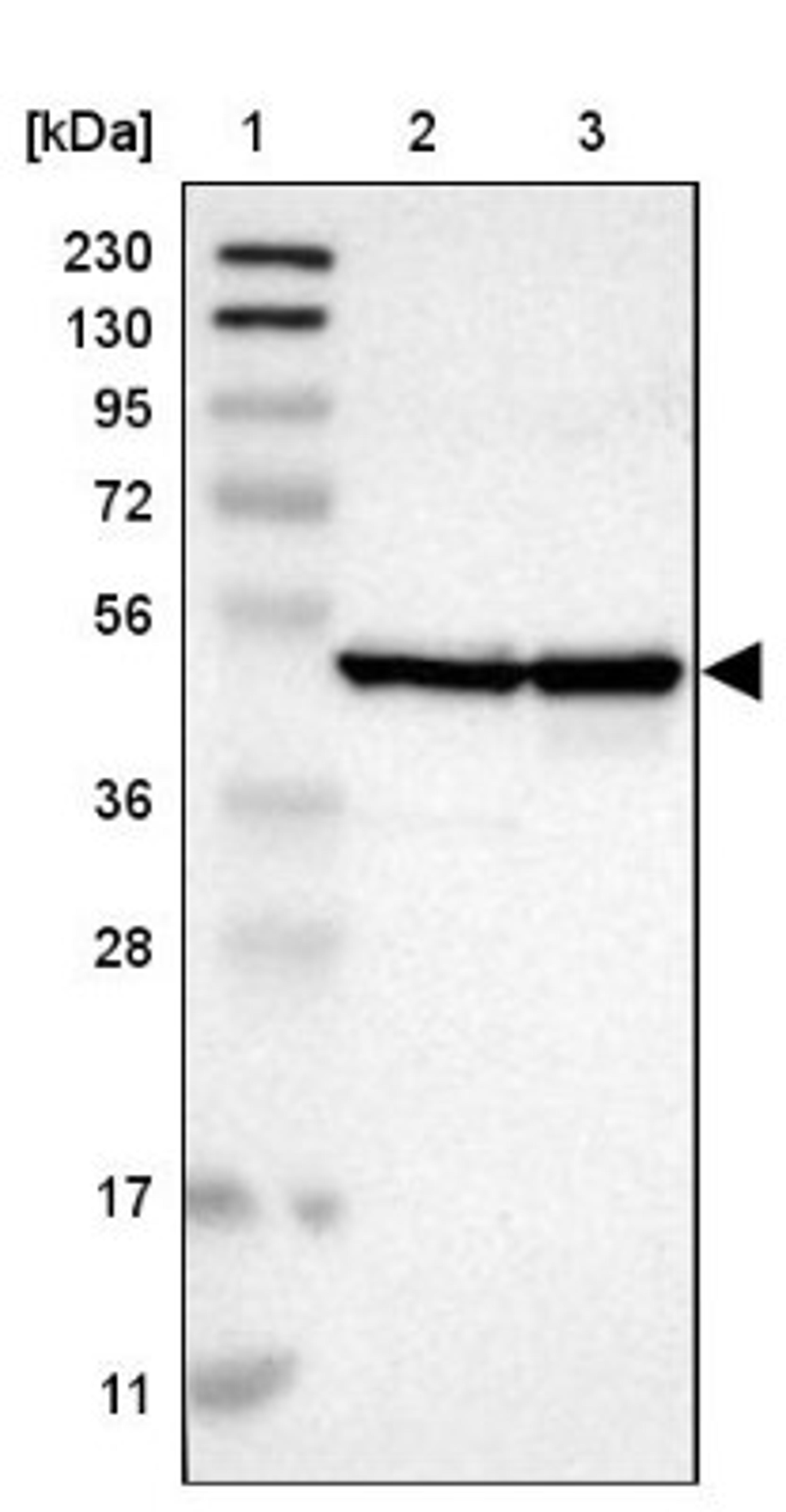 Western Blot: Cyclin B2 Antibody [NBP1-89657] - Lane 1: Marker [kDa] 230, 130, 95, 72, 56, 36, 28, 17, 11<br/>Lane 2: Human cell line RT-4<br/>Lane 3: Human cell line U-251MG sp