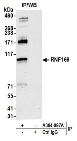 Detection of human RNF169 by western blot of immunoprecipitates.