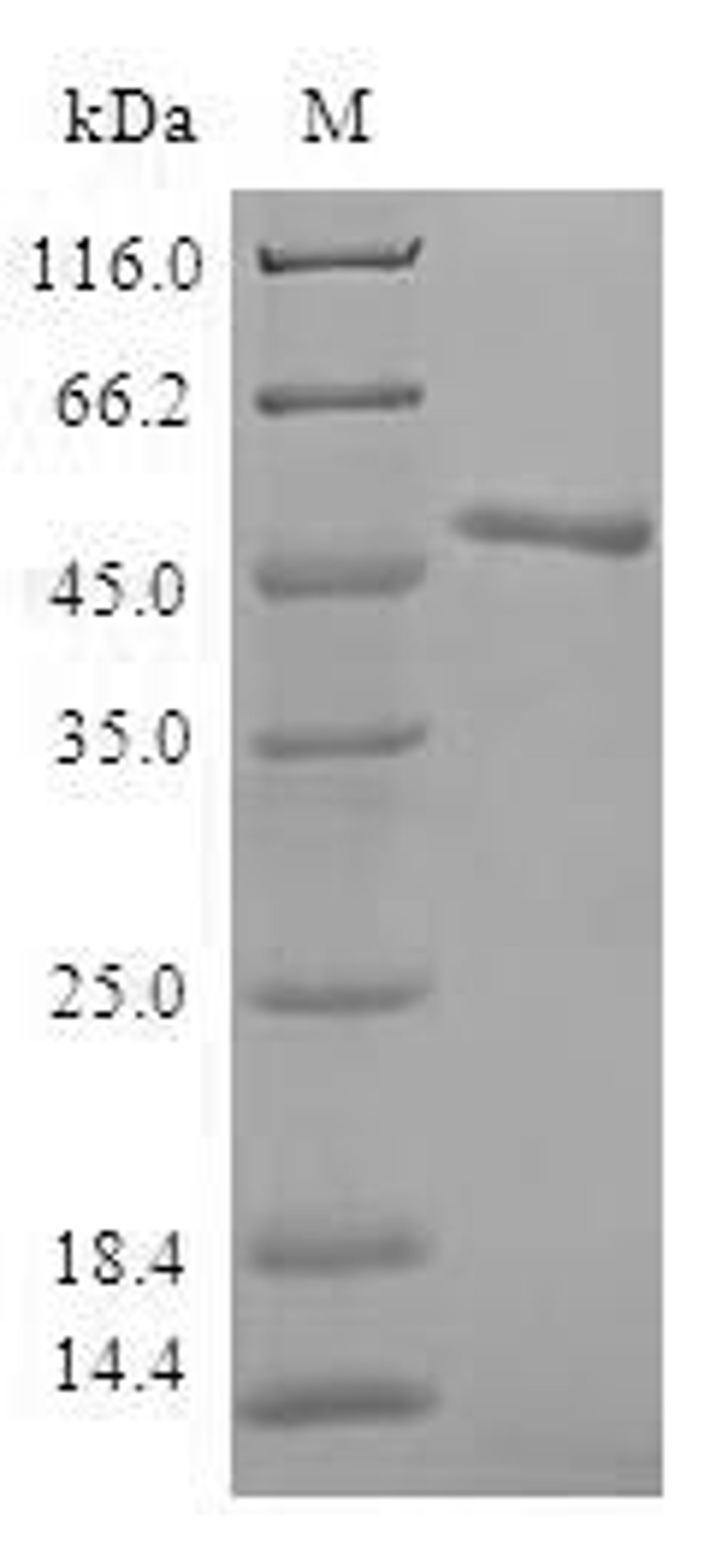 (Tris-Glycine gel) Discontinuous SDS-PAGE (reduced) with 5% enrichment gel and 15% separation gel.