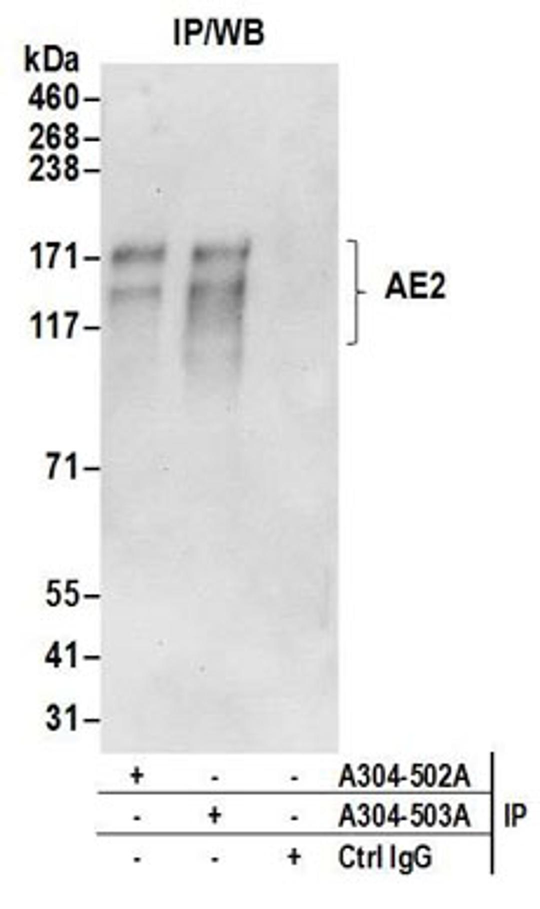 Detection of human AE2 by western blot of immunoprecipitates.