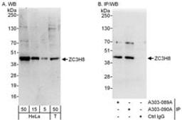 Detection of human ZC3H8 by western blot and immunoprecipitation.