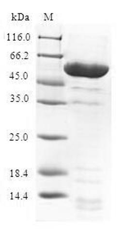 (Tris-Glycine gel) Discontinuous SDS-PAGE (reduced) with 5% enrichment gel and 15% separation gel.