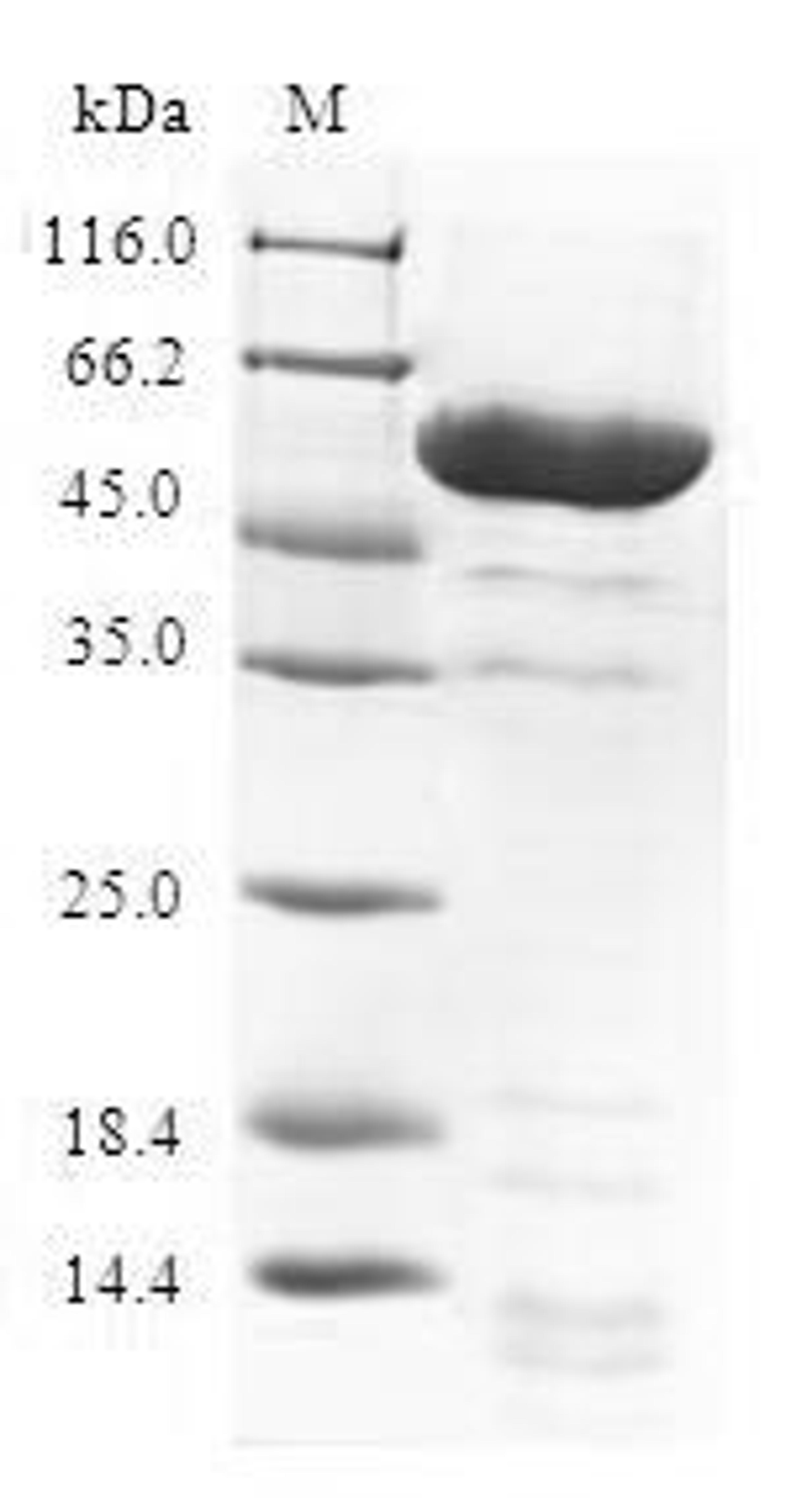 (Tris-Glycine gel) Discontinuous SDS-PAGE (reduced) with 5% enrichment gel and 15% separation gel.