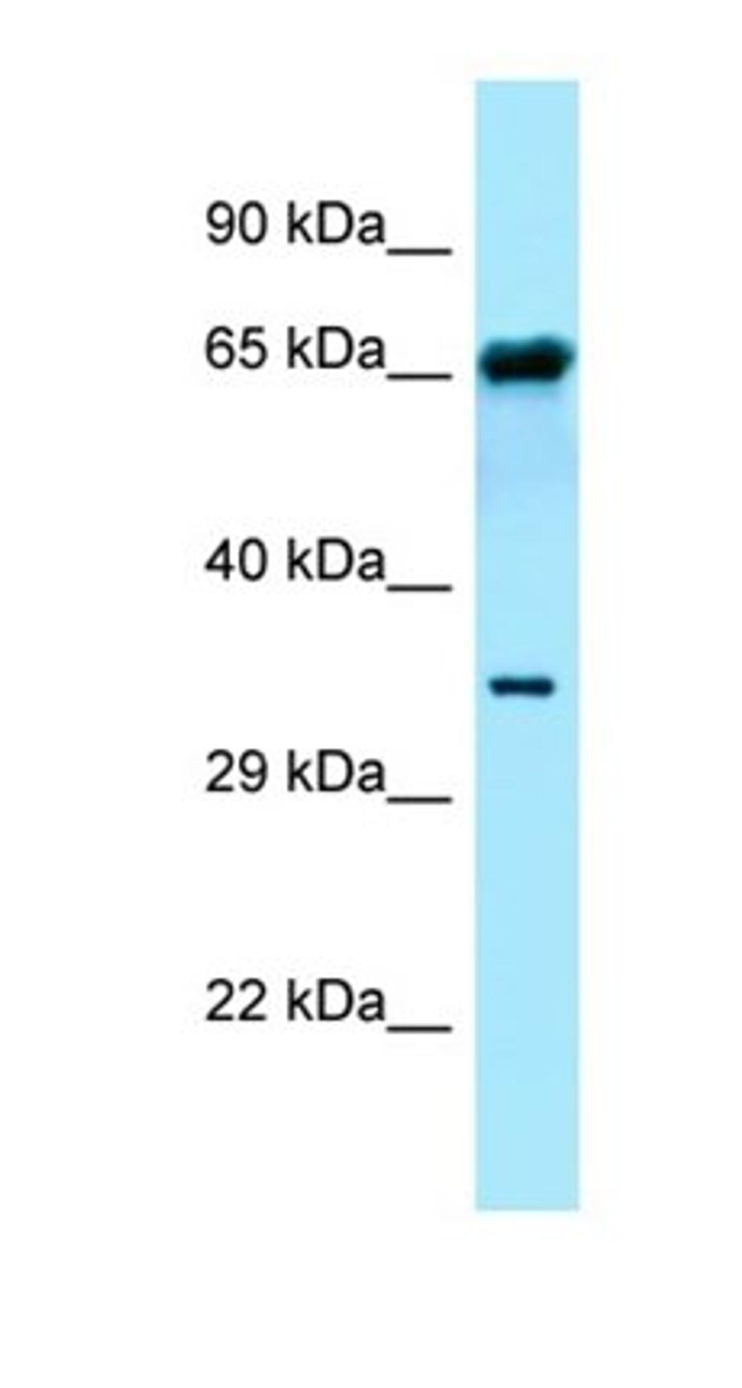 Western blot analysis of ACHN Whole Cell tissue using FPGT antibody