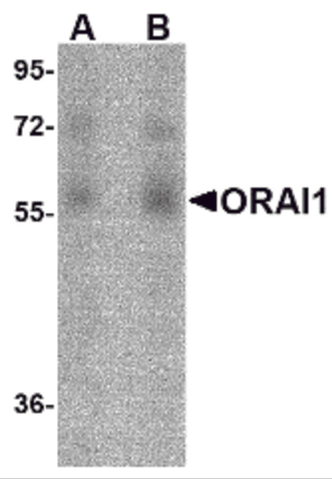 Western blot analysis of ORAI1 in human ovary tissue lysate with ORAI1 antibody at (A) 1 and (B) 2 &#956;g/mL.