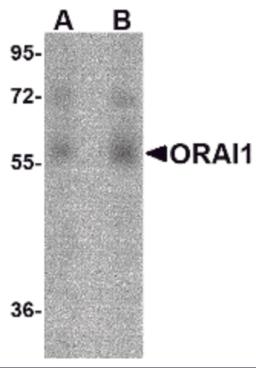 Western blot analysis of ORAI1 in human ovary tissue lysate with ORAI1 antibody at (A) 1 and (B) 2 &#956;g/mL.