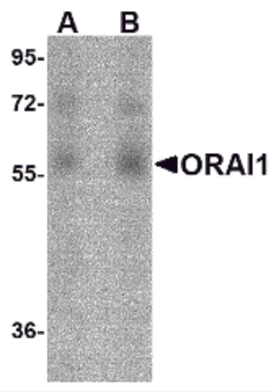 Western blot analysis of ORAI1 in human ovary tissue lysate with ORAI1 antibody at (A) 1 and (B) 2 μg/mL.