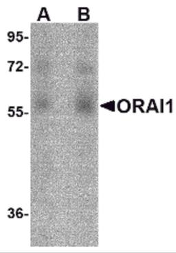 Western blot analysis of ORAI1 in human ovary tissue lysate with ORAI1 antibody at (A) 1 and (B) 2 μg/mL.