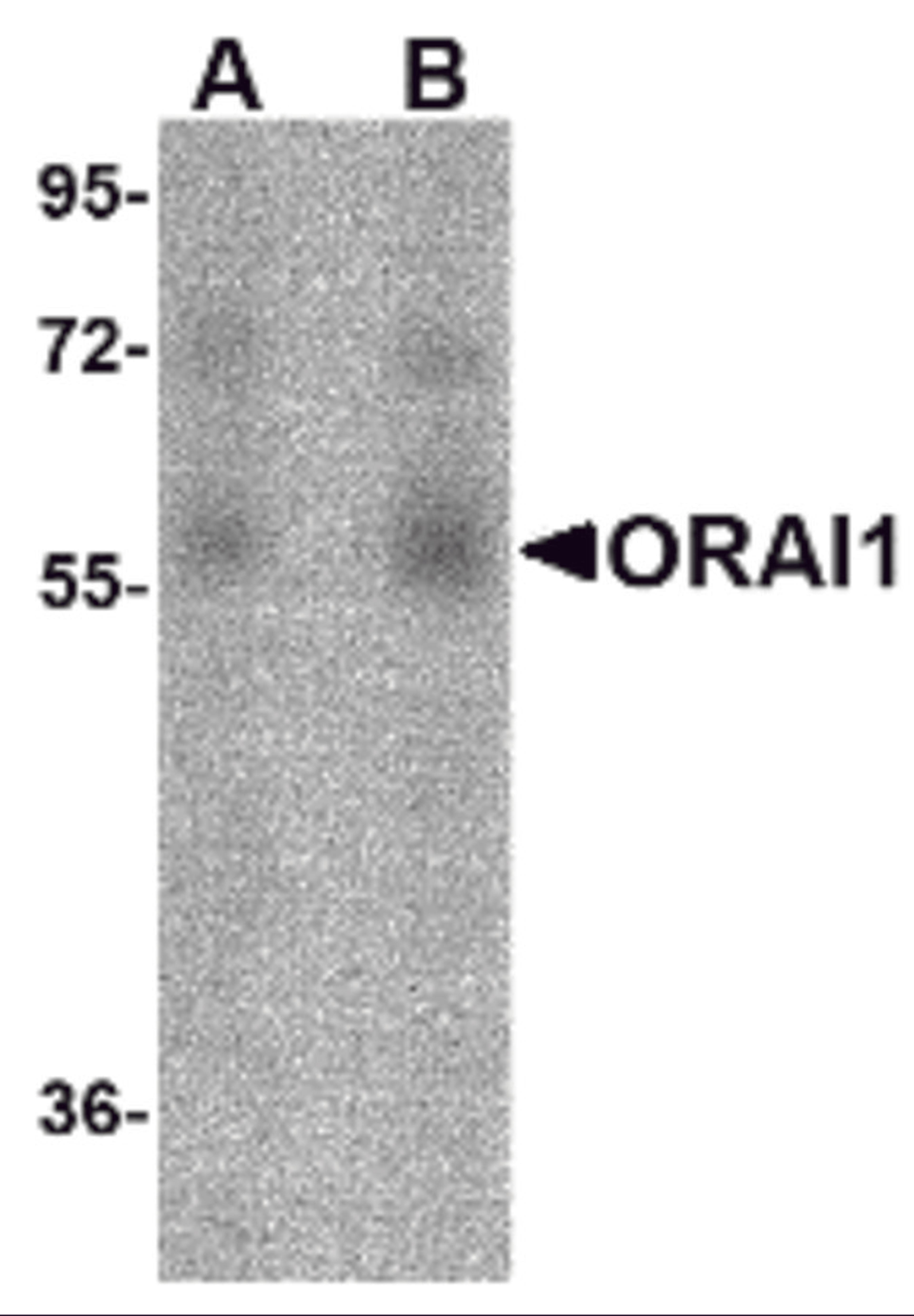 Western blot analysis of ORAI1 in human ovary tissue lysate with ORAI1 antibody at (A) 1 and (B) 2 μg/mL.