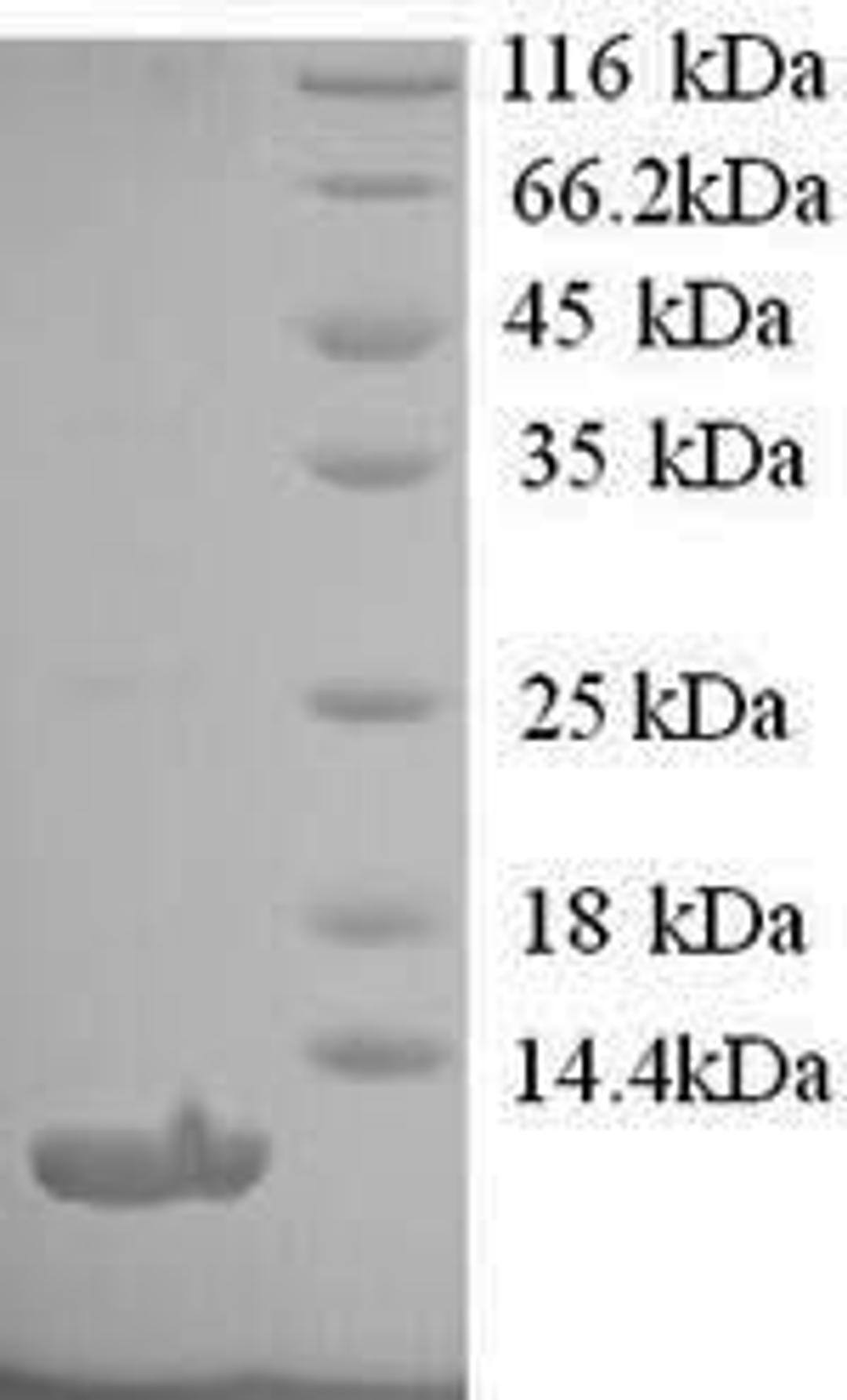 (Tris-Glycine gel) Discontinuous SDS-PAGE (reduced) with 5% enrichment gel and 15% separation gel.