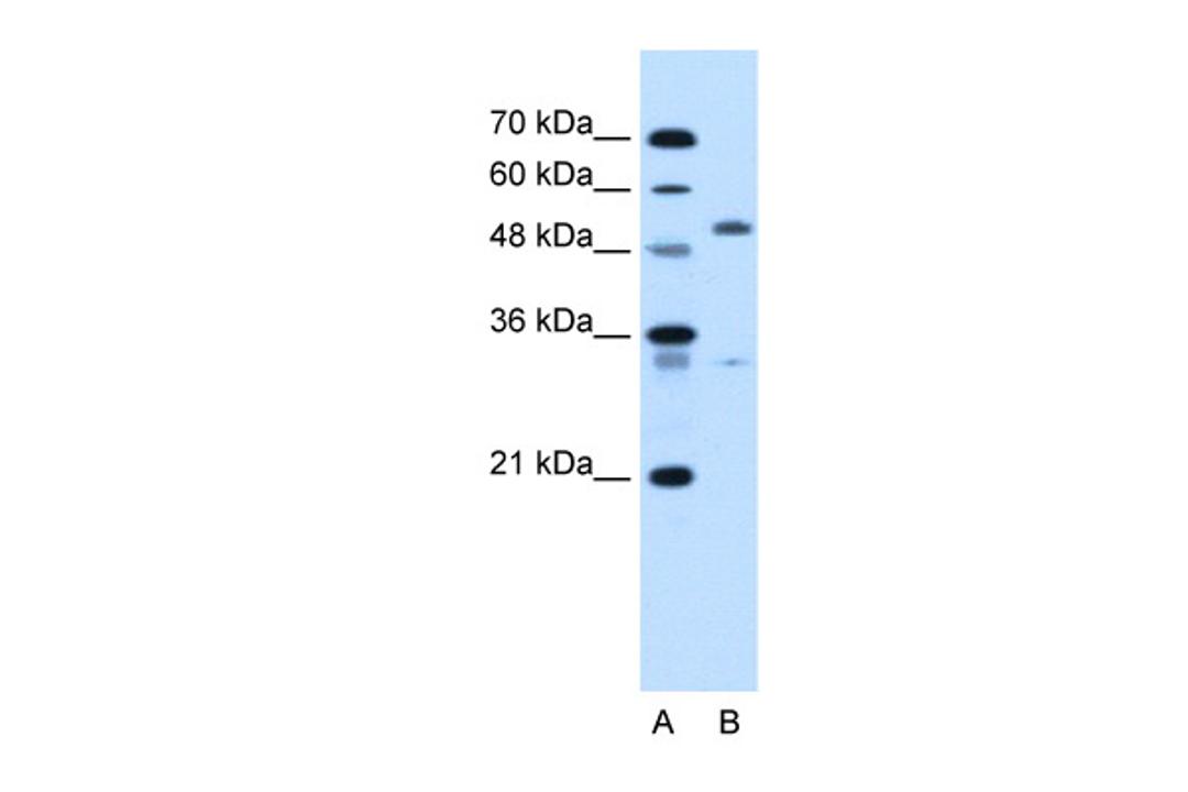 Antibody used in WB on Human HepG2 at 5.0 ug/ml.