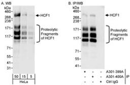 Detection of human HCF1 by western blot and immunoprecipitation.