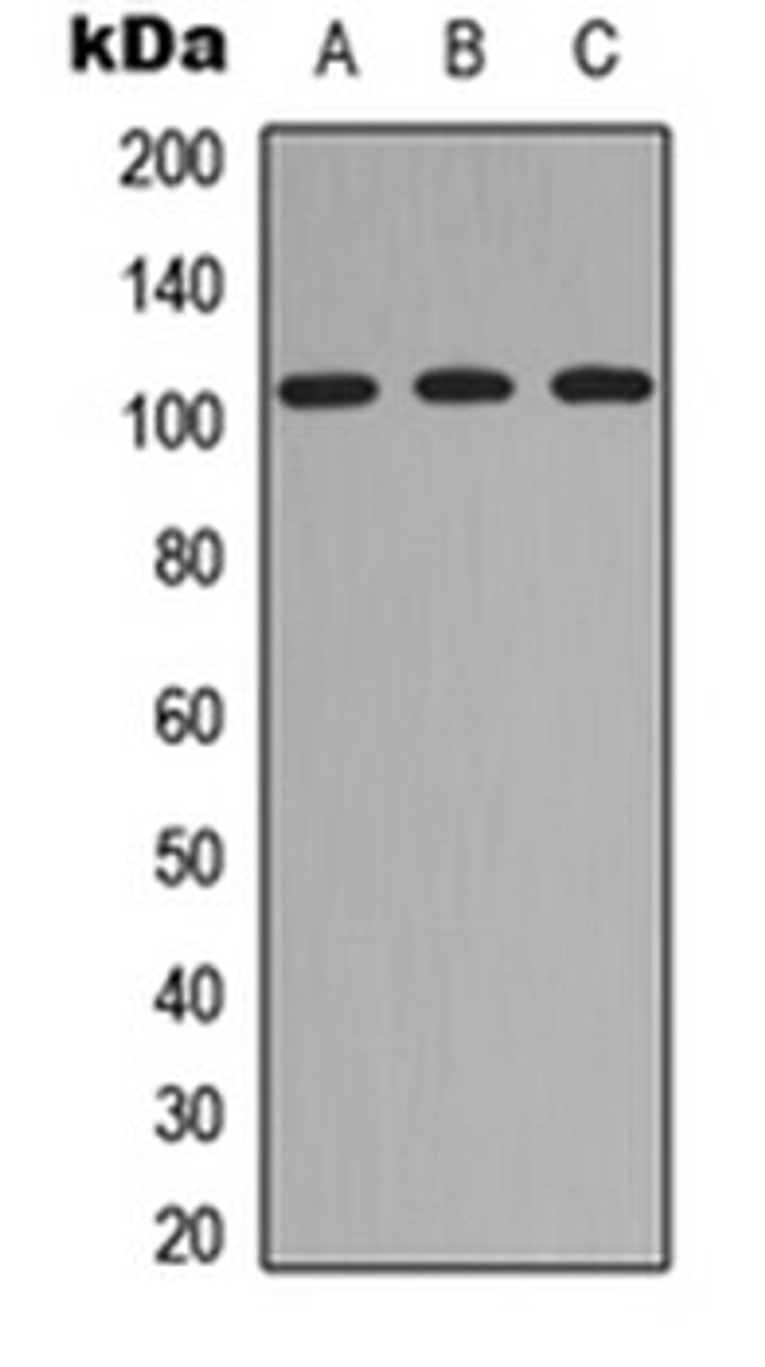 Western blot analysis of HEK293T (Lane 1), Raw264.7 (Lane 2), PC12 (Lane 3) whole cell lysates using ITIH4 70k antibody