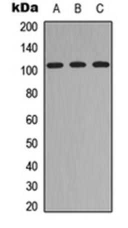 Western blot analysis of HEK293T (Lane 1), Raw264.7 (Lane 2), PC12 (Lane 3) whole cell lysates using ITIH4 70k antibody