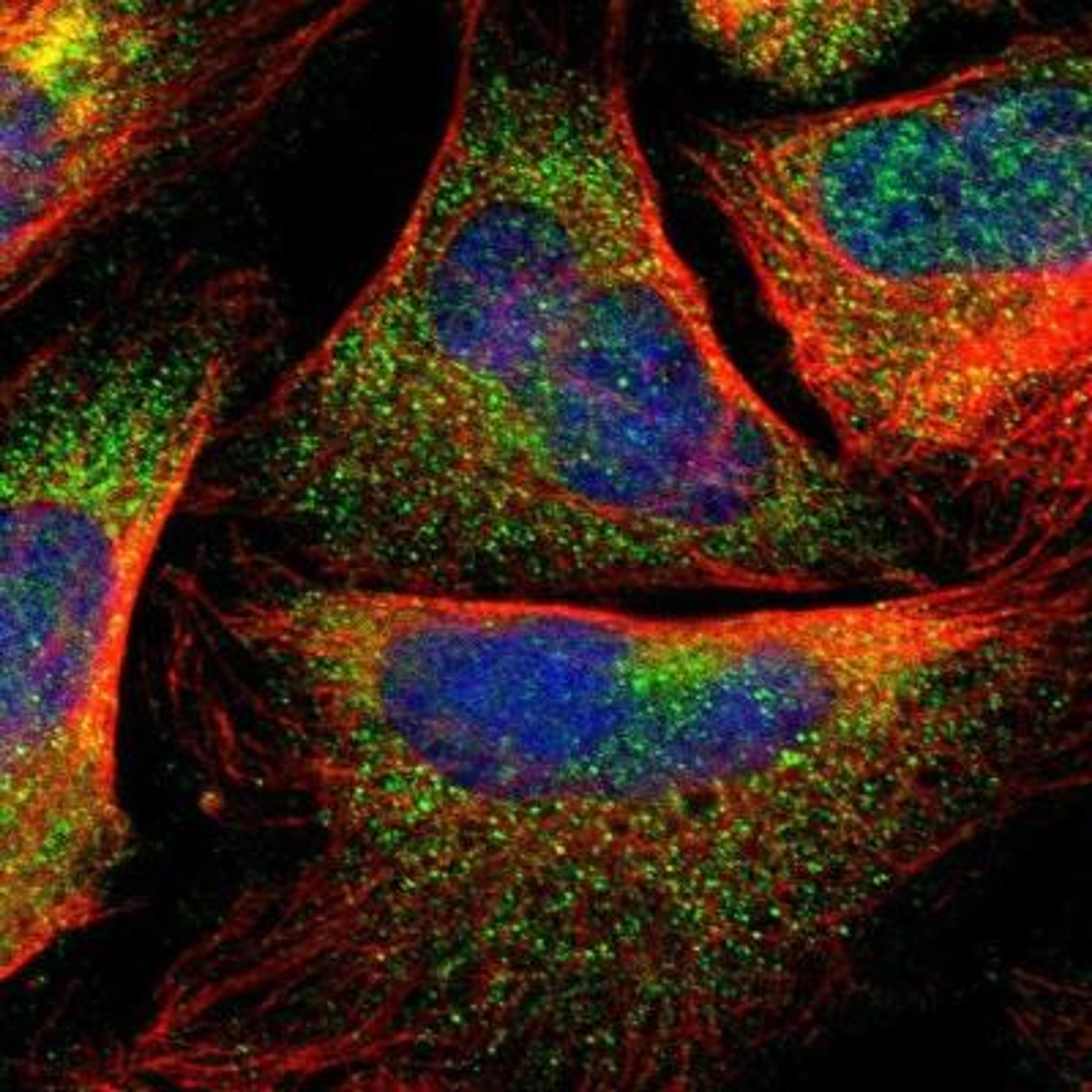 Immunocytochemistry/Immunofluorescence: Complement Component C1r Antibody [NBP1-86527] - Immunofluorescent staining of human cell line U-2 OS shows positivity in cytoplasm.