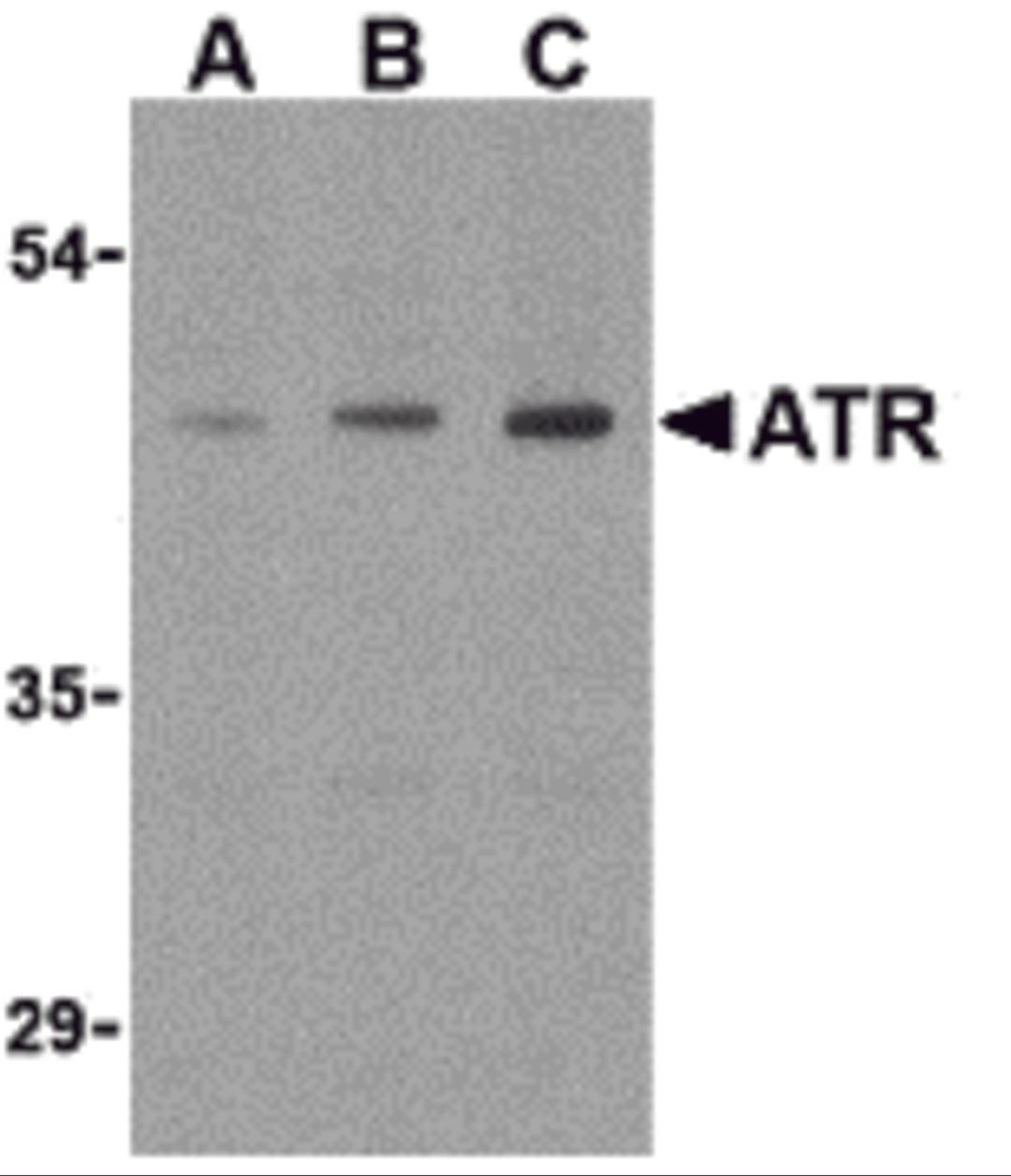 Western blot analysis of ATR in HepG2 cell lysates with ATR antibody (IN) at (A) 0.5, (B) 1, and (C) 2 &#956;g/mL. 