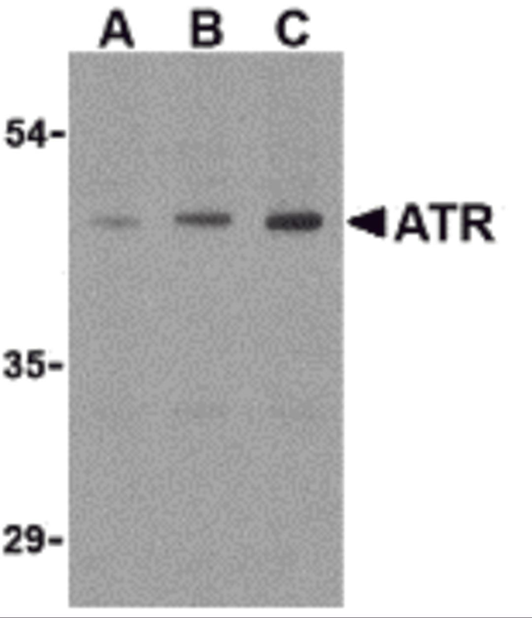 Western blot analysis of ATR in HepG2 cell lysates with ATR antibody (IN) at (A) 0.5, (B) 1, and (C) 2 μg/mL.