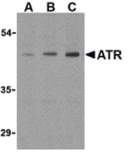Western blot analysis of ATR in HepG2 cell lysates with ATR antibody (IN) at (A) 0.5, (B) 1, and (C) 2 μg/mL.