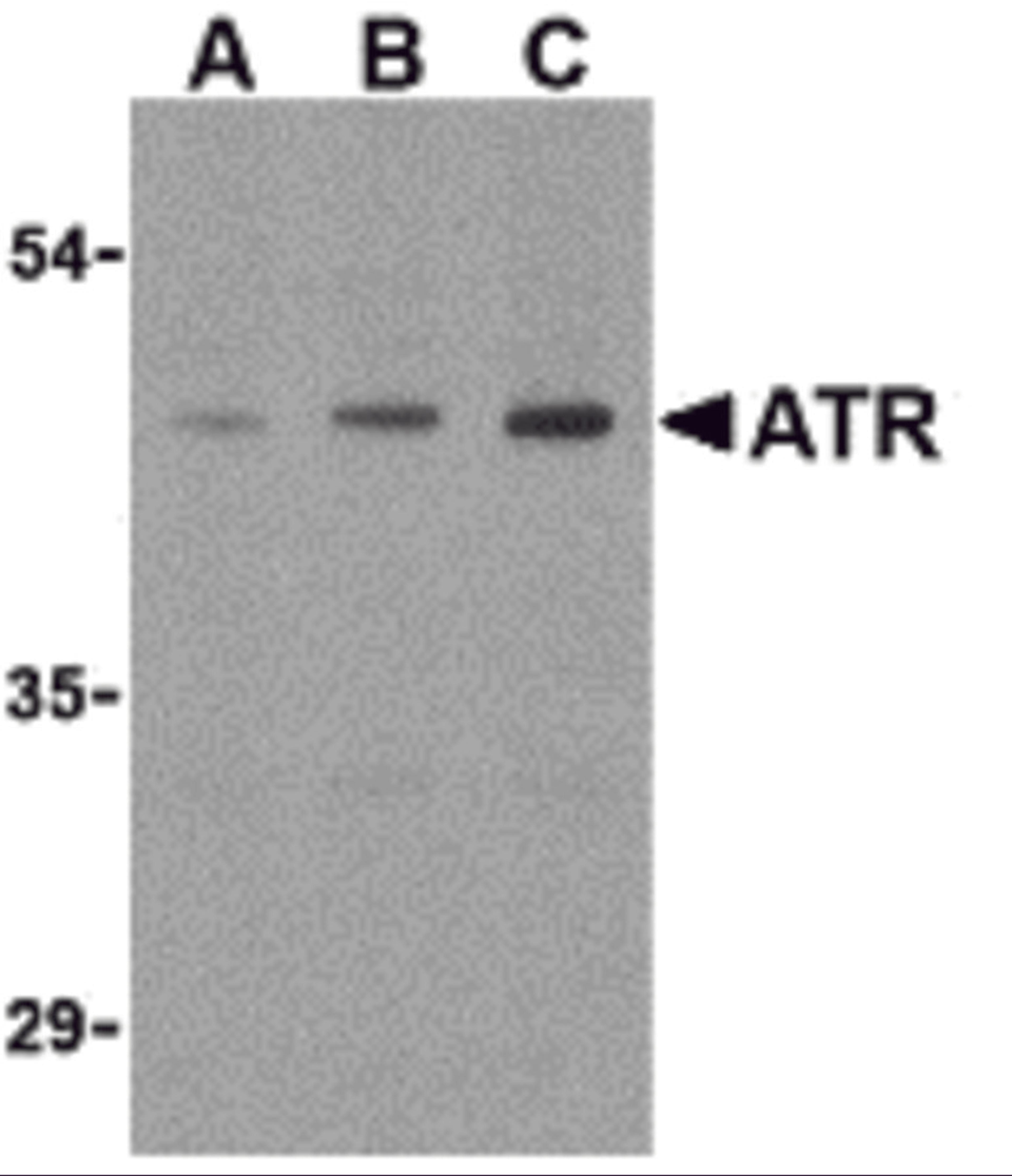Western blot analysis of ATR in HepG2 cell lysates with ATR antibody (IN) at (A) 0.5, (B) 1, and (C) 2 μg/mL.