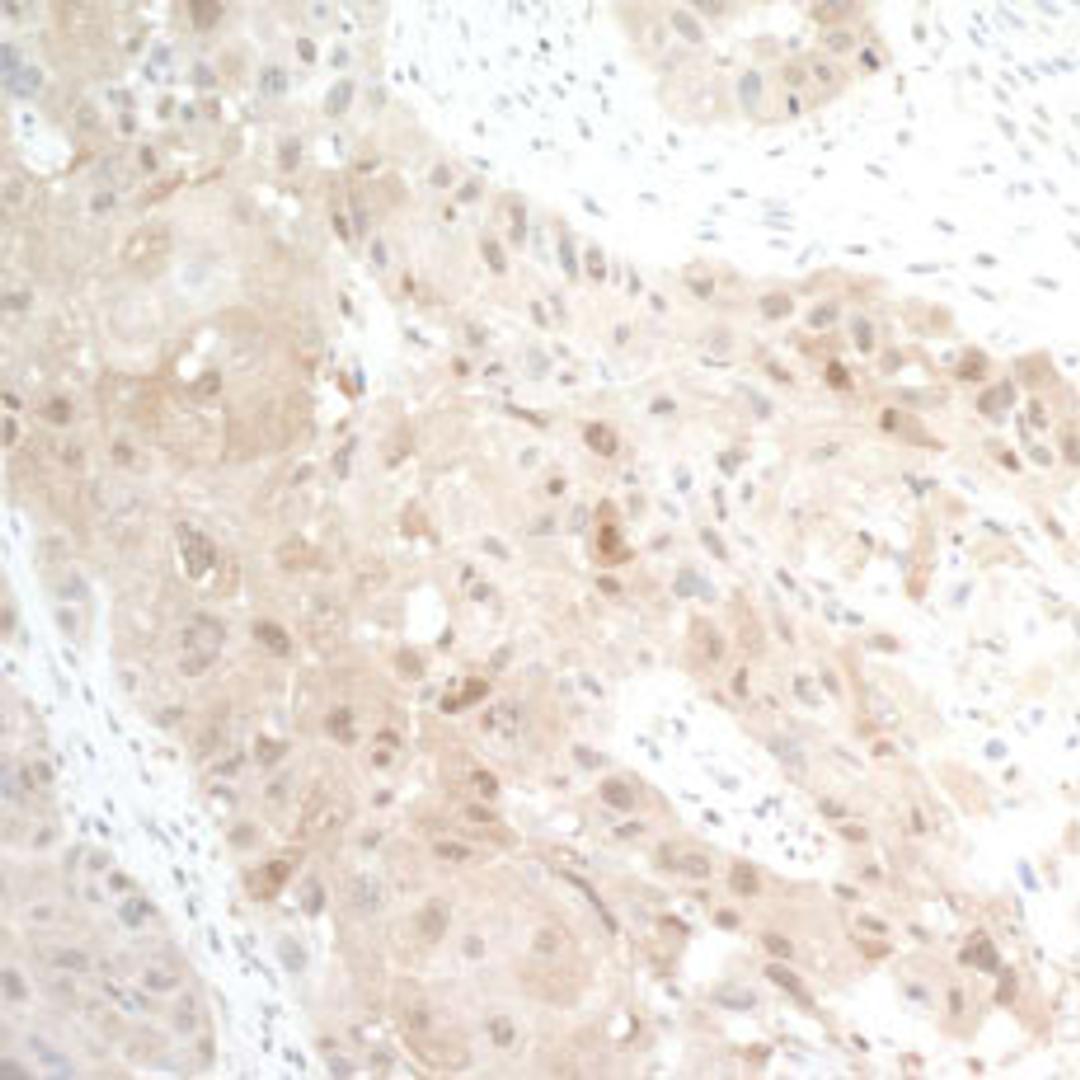 Detection of human PBEF by immunohistochemistry.