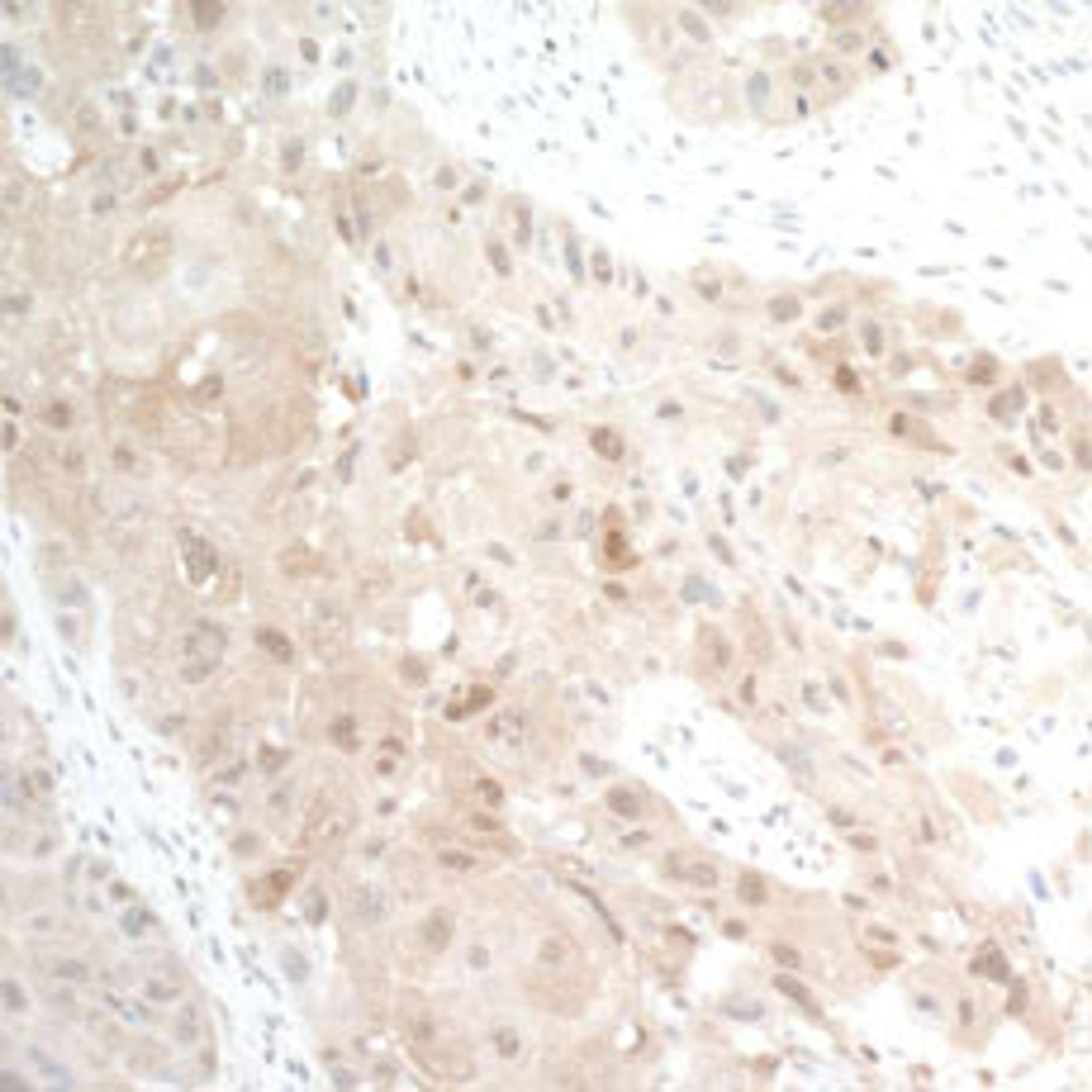 Detection of human PBEF by immunohistochemistry.