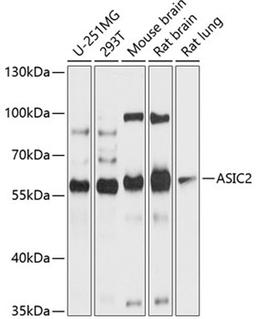 Western blot - ASIC2 antibody (A10496)