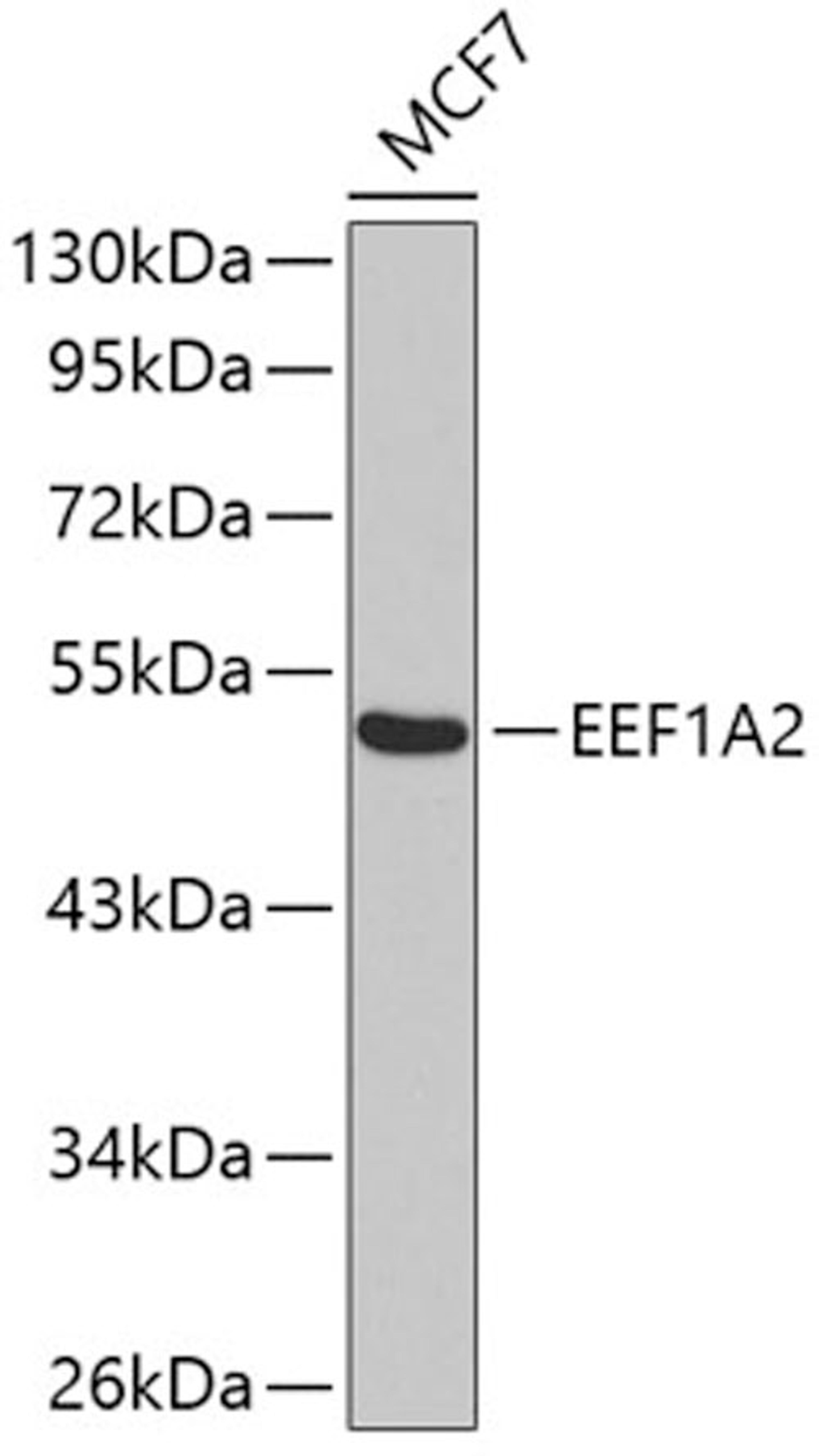 Western blot - EEF1A2 antibody (A7327)