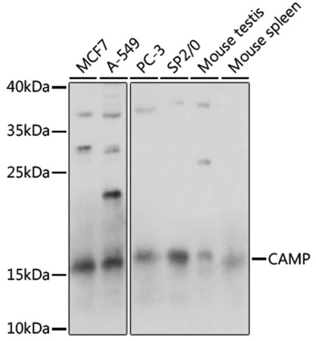 Western blot - CAMP antibody (A15653)