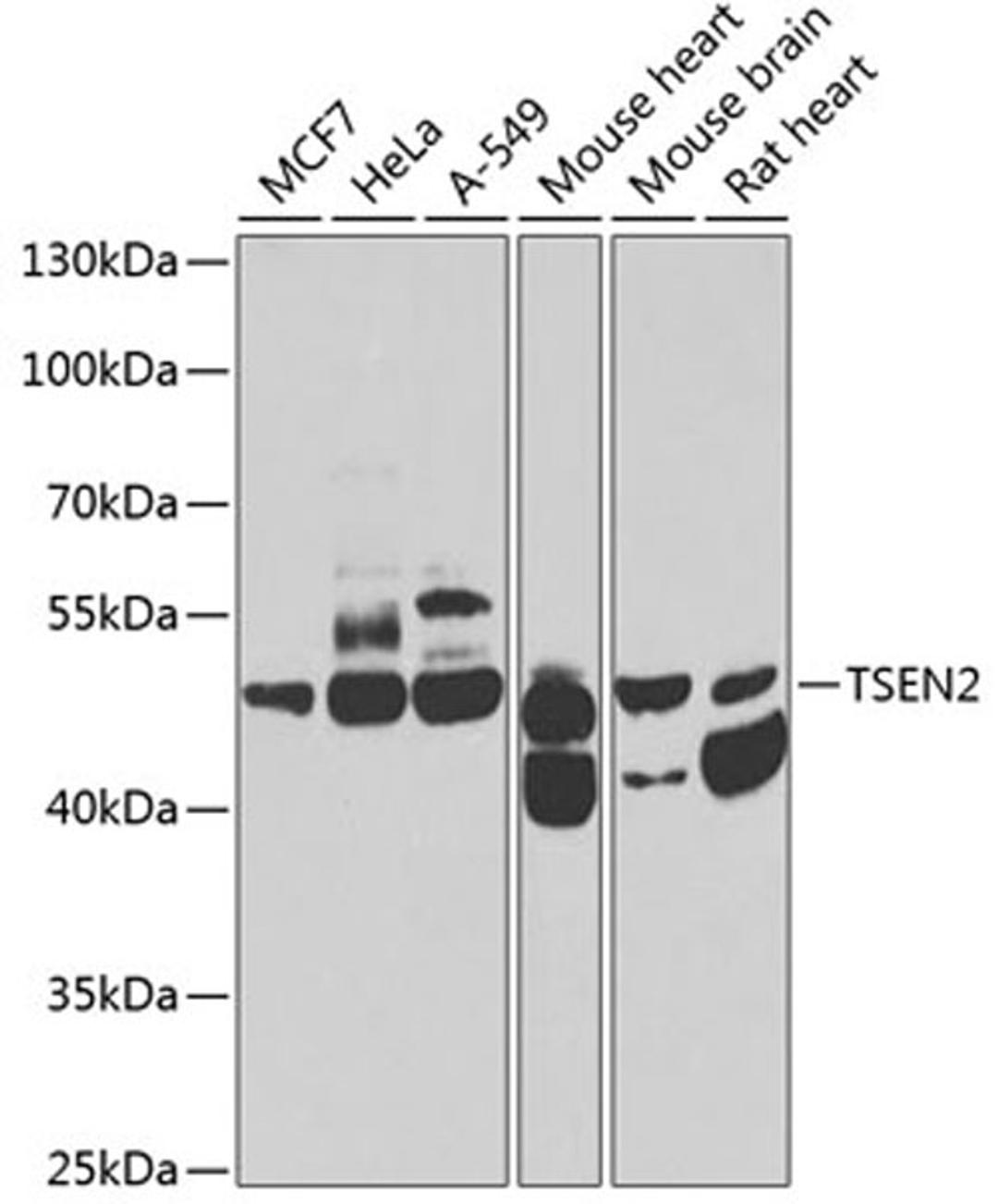 Western blot - TSEN2 antibody (A7838)