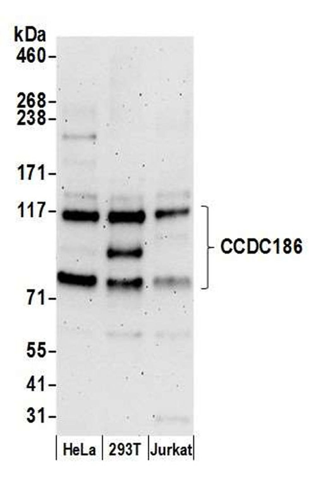 Detection of human CCDC186 by WB.