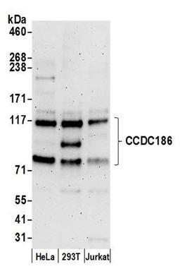 Detection of human CCDC186 by WB.