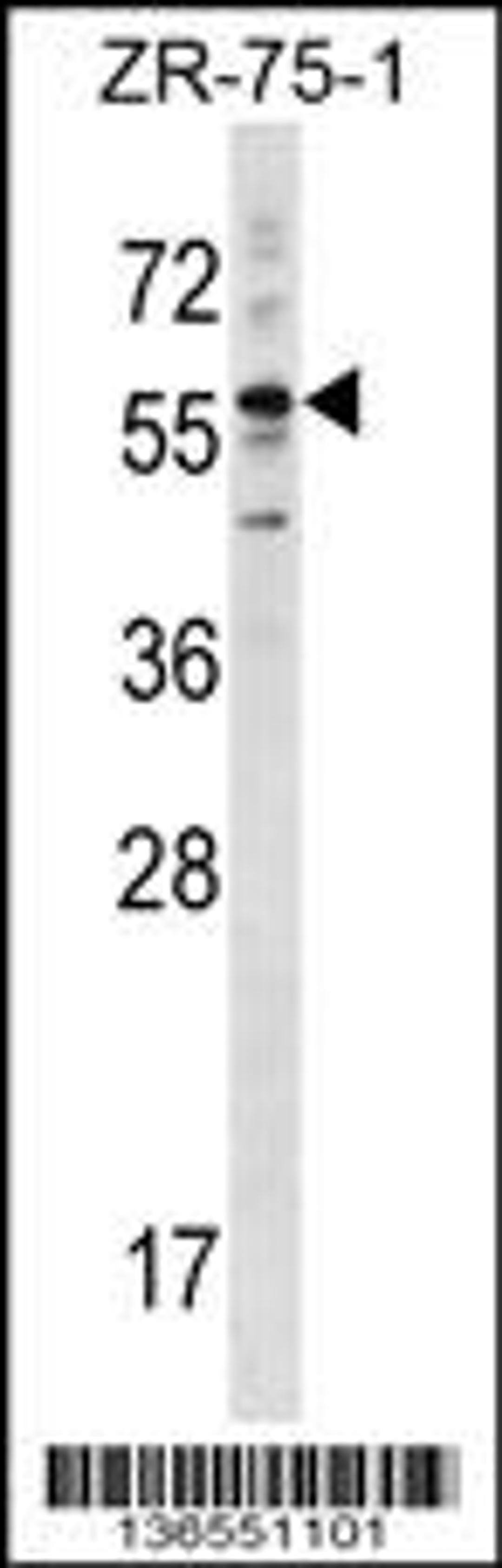 Western blot analysis in ZR-75-1 cell line lysates (35ug/lane).