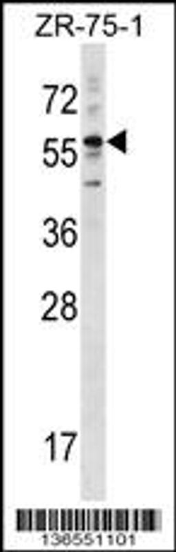 Western blot analysis in ZR-75-1 cell line lysates (35ug/lane).