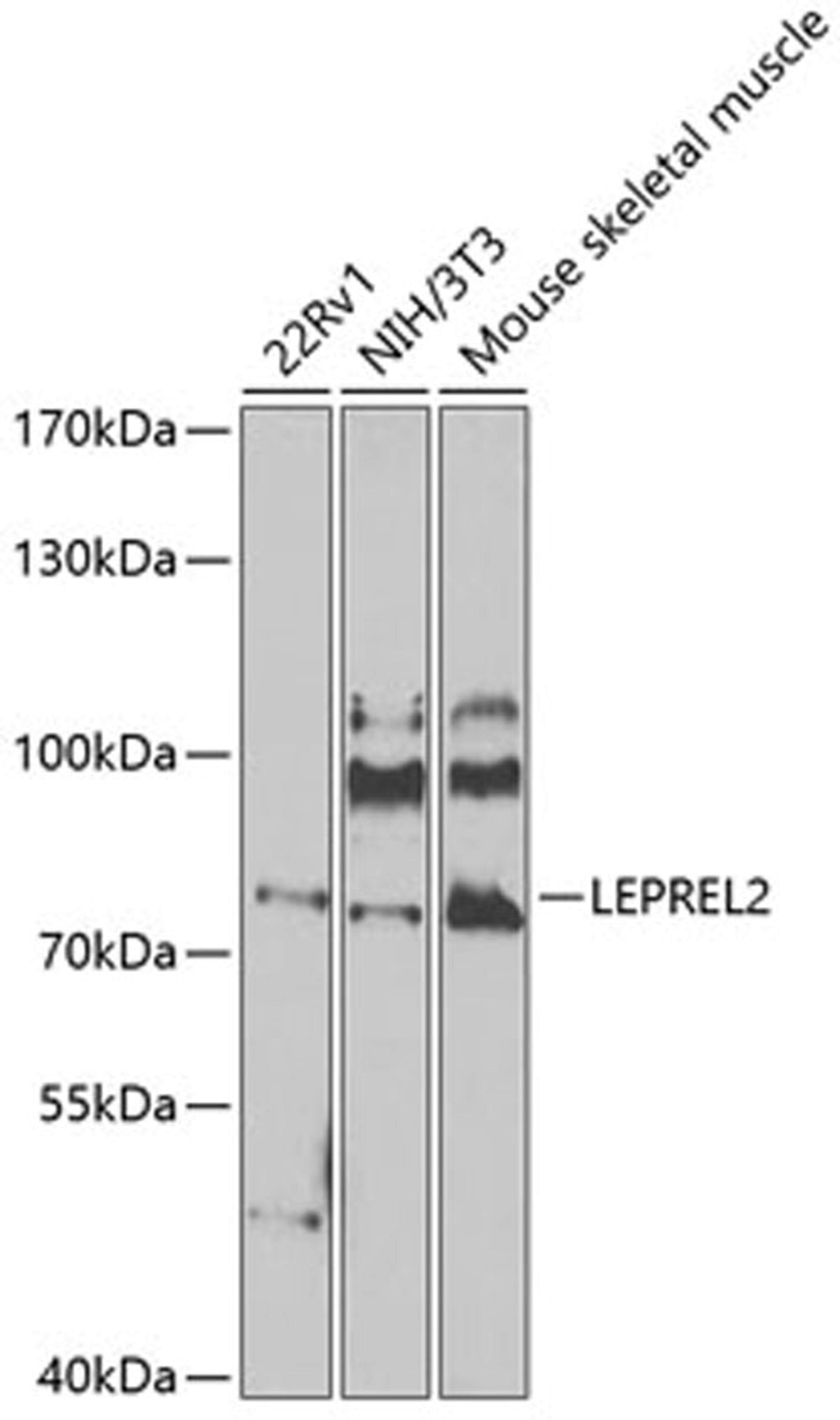 Western blot - LEPREL2 antibody (A8062)