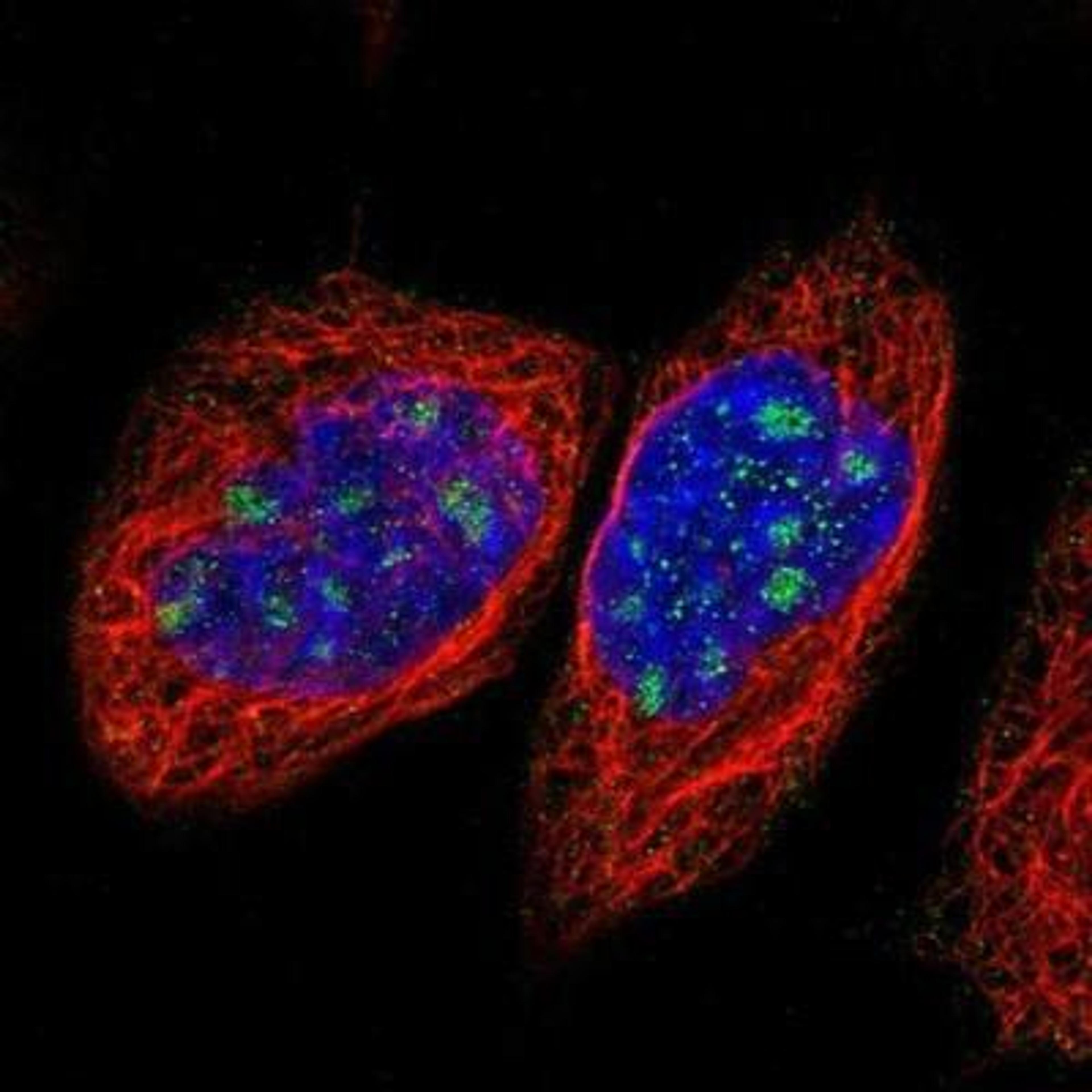 Immunocytochemistry/ Immunofluorescence: NOL11 Antibody [NBP1-90522] -  Staining of human cell line A-431 shows positivity in nucleoli.