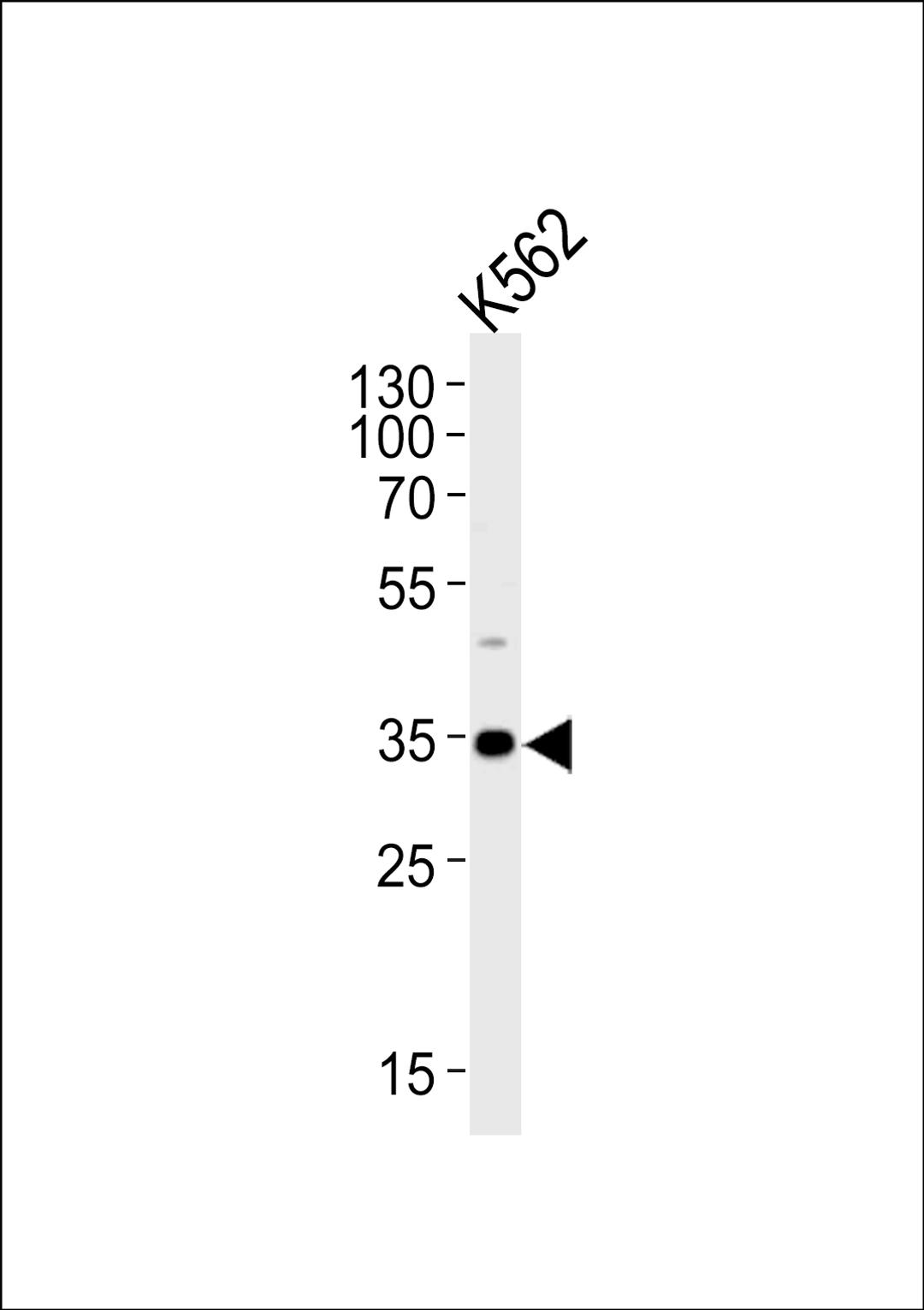 Western blot analysis of lysate from K562 cell line, using BBS5 Antibody at 1:1000.