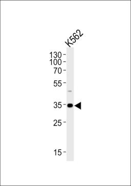 Western blot analysis of lysate from K562 cell line, using BBS5 Antibody at 1:1000.