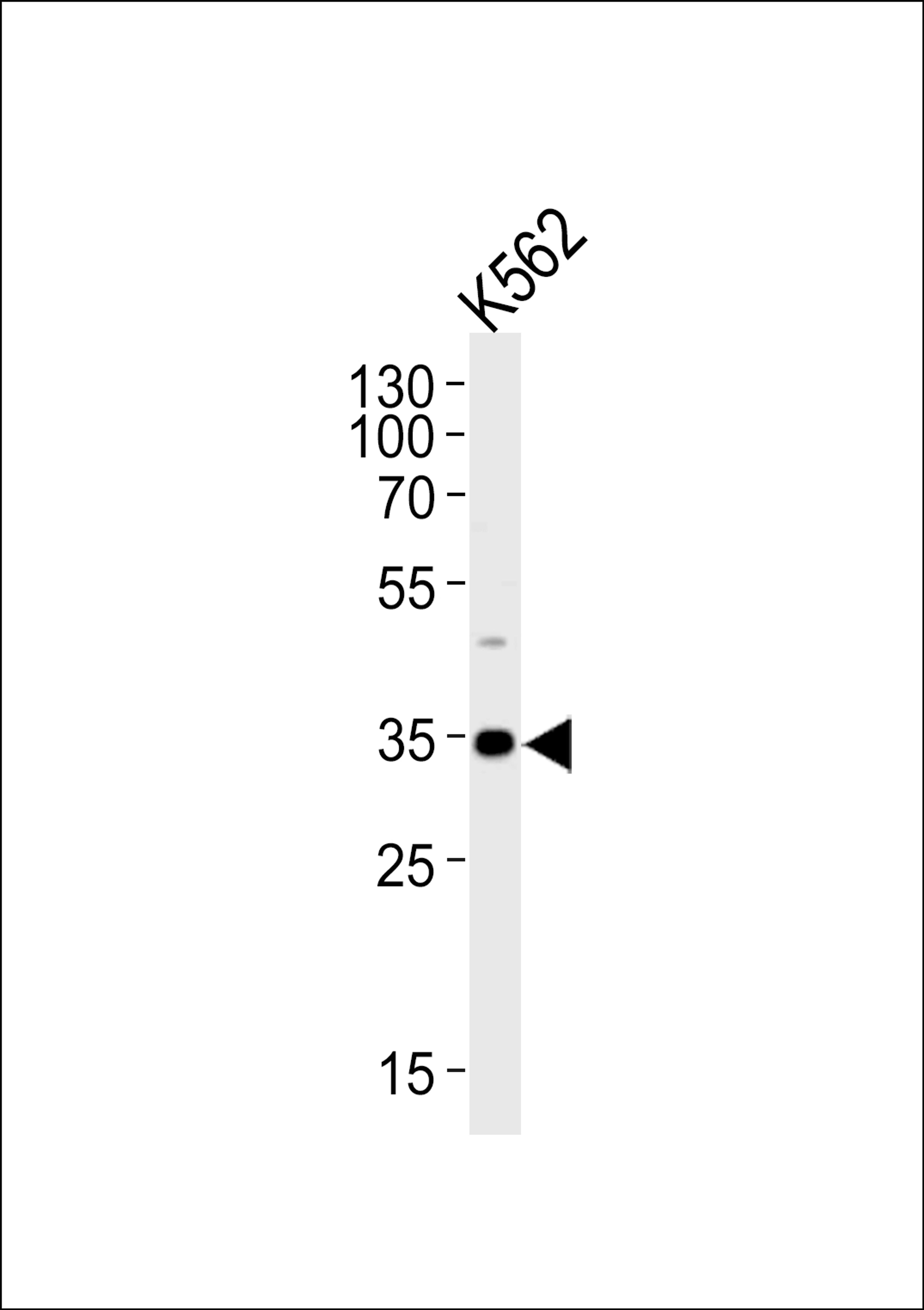 Western blot analysis of lysate from K562 cell line, using BBS5 Antibody at 1:1000.