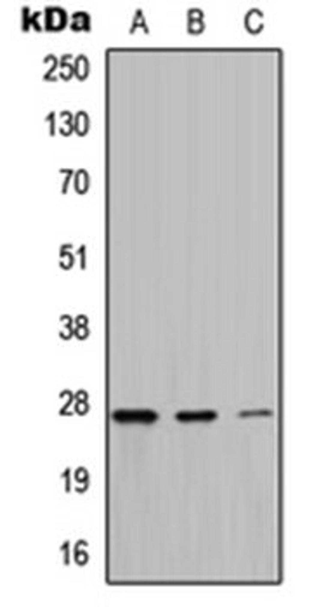 Western blot analysis of HeLa (Lane 1), A549 (Lane 2), PC12 (Lane 3) whole cell lysates using MT-ATP6 antibody