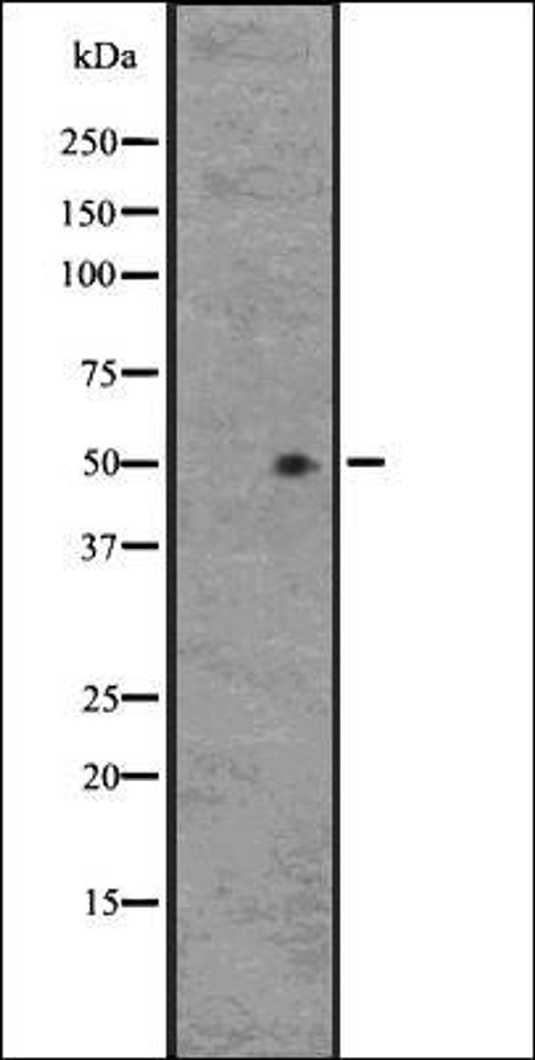 Western blot analysis of HEK293 cells using GPR33 antibody