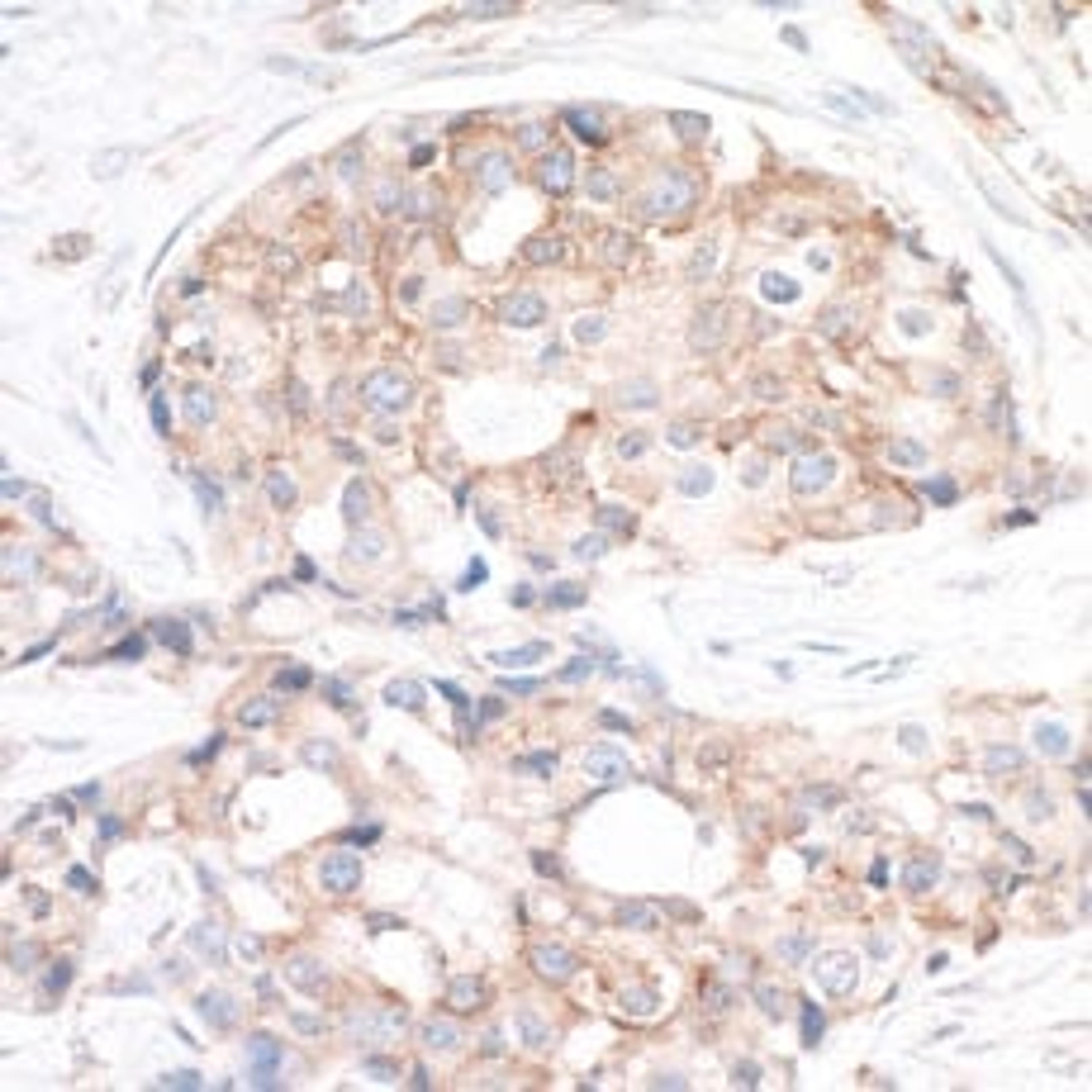 Detection of human RPS6 by immunohistochemistry.