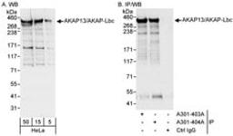 Detection of human AKAP13/AKAP-Lbc by western blot and immunoprecipitation.