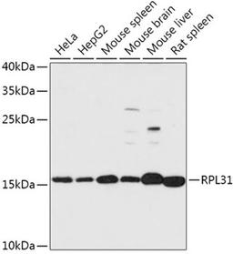 Western blot - RPL31 antibody (A17527)