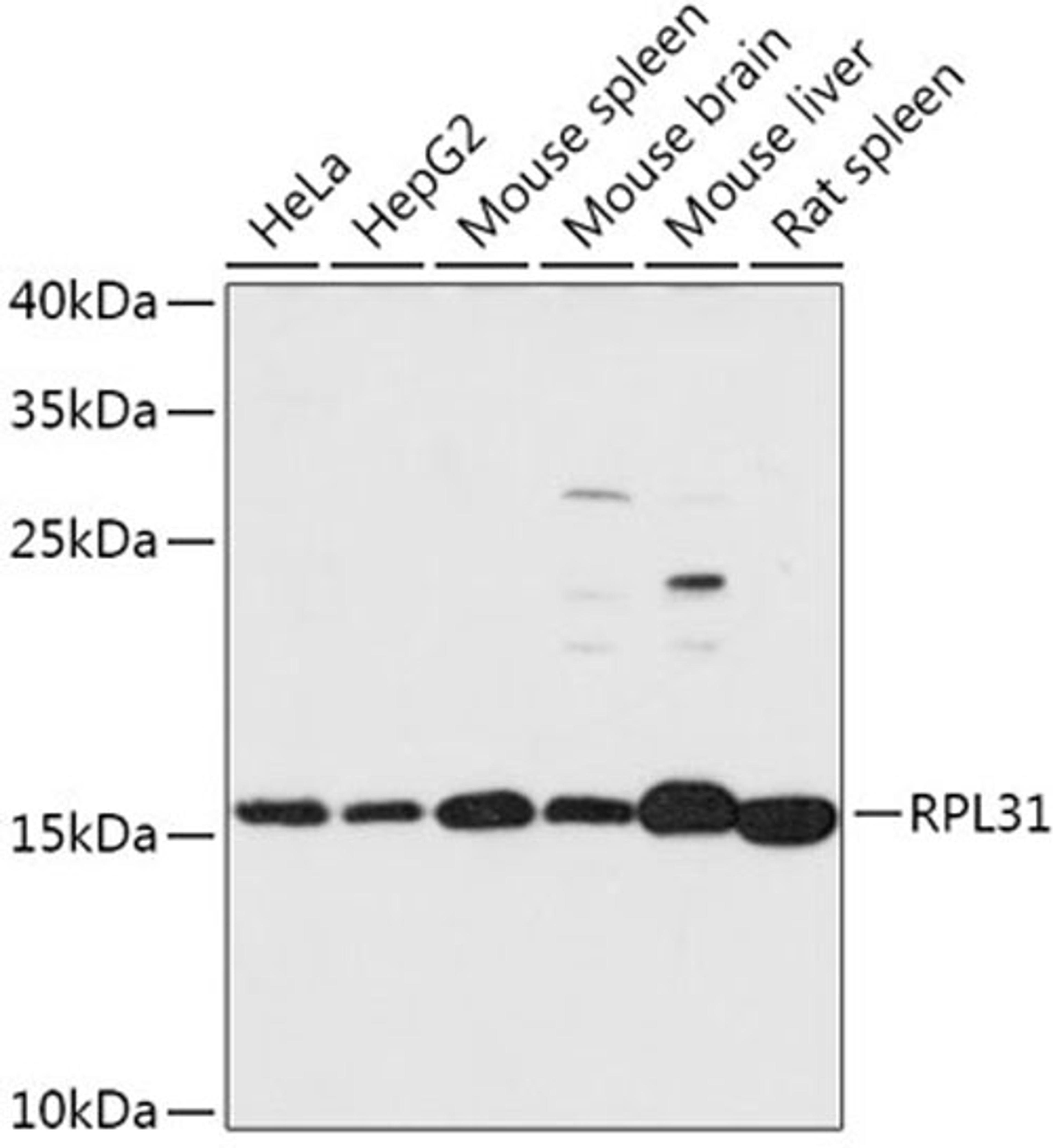 Western blot - RPL31 antibody (A17527)